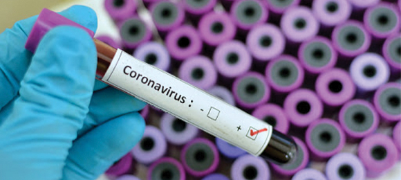 Coronavirus: Sindacati ed ABI Firmano Nuovo Protocollo Sicurezza Lavoratori
